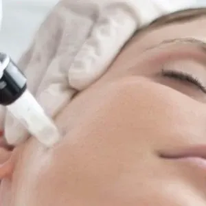 YOUNGER SKIN