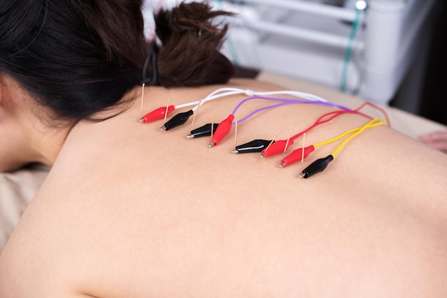 Aplicación de DIPEA en cuello para aliviar contracturas.